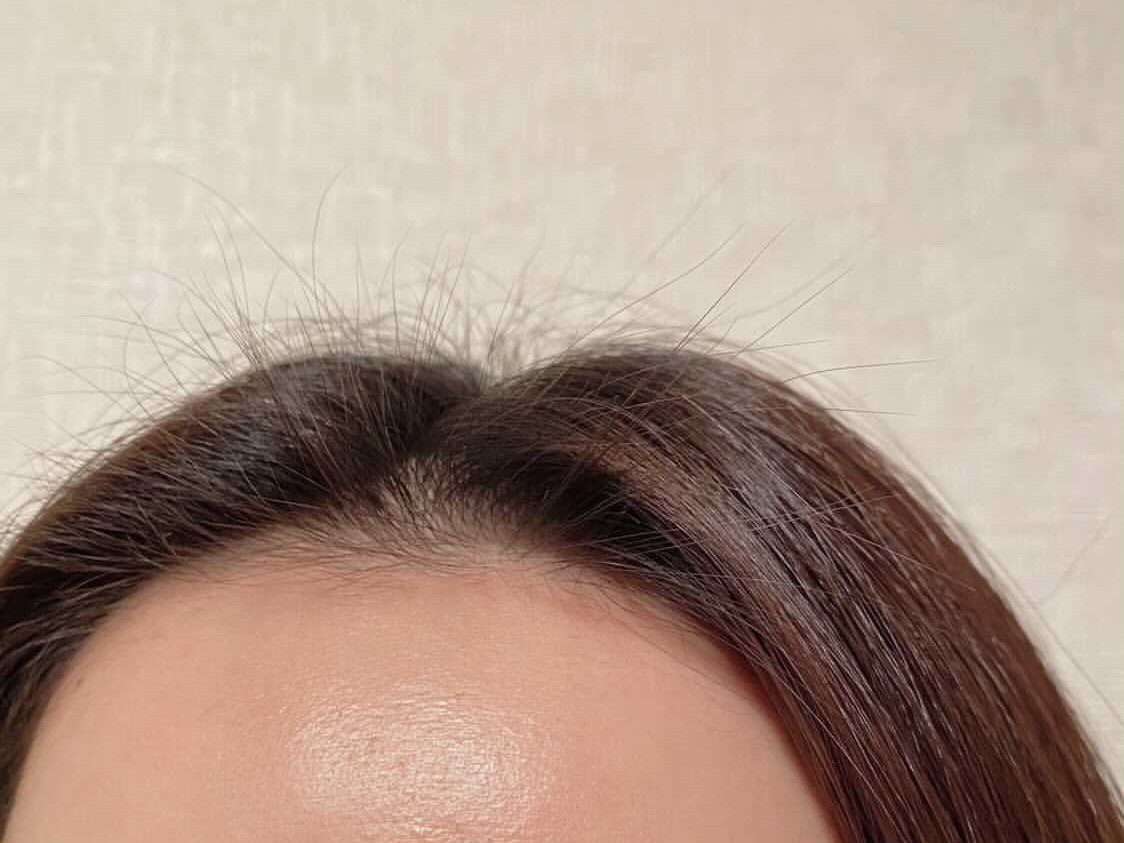 産後のツンツンした髪の正体と対処法3つを現役美容師が徹底解説 Tetsuya Haircare 産後のツンツンした髪の正体と対処法3つを現役美容師が徹底解説 Tetsuya Haircare